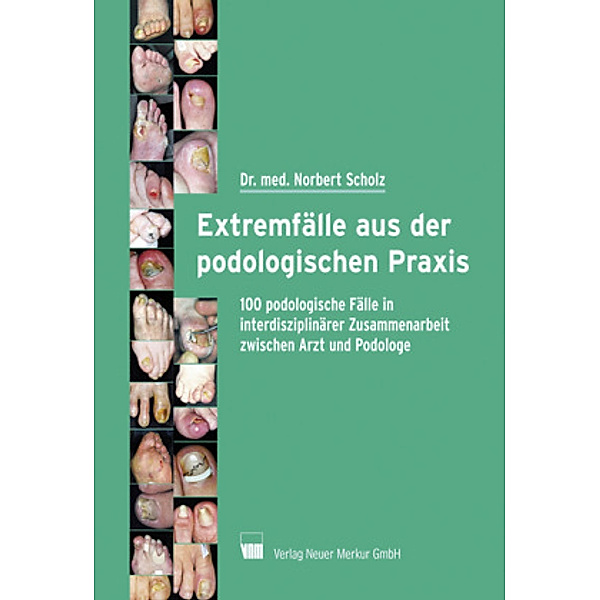 Extremfälle aus der podologischen Praxis, Norbert Scholz