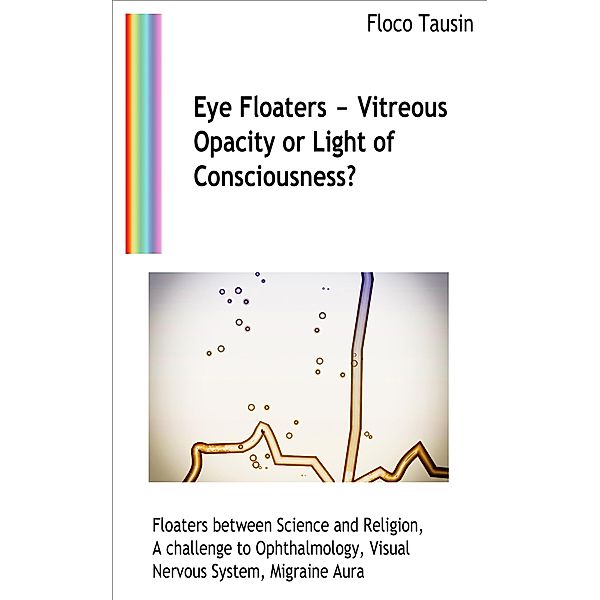 Eye Floaters - Vitreous Opacity or Light of Consciousness?, Floco Tausin