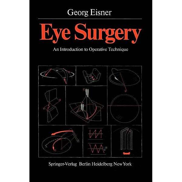 Eye Surgery, Georg Eisner