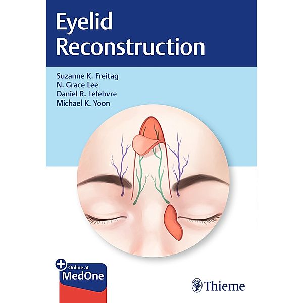 Eyelid Reconstruction, Suzanne K. Freitag, Nahyoung Grace Lee, Daniel R. Lefebvre, Michael K. Yoon