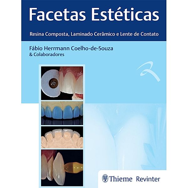 Facetas Estéticas - Resina Composta, Laminado Cerâmico e Lente de Contato, Fábio Herrmann Coelho-De-Souza