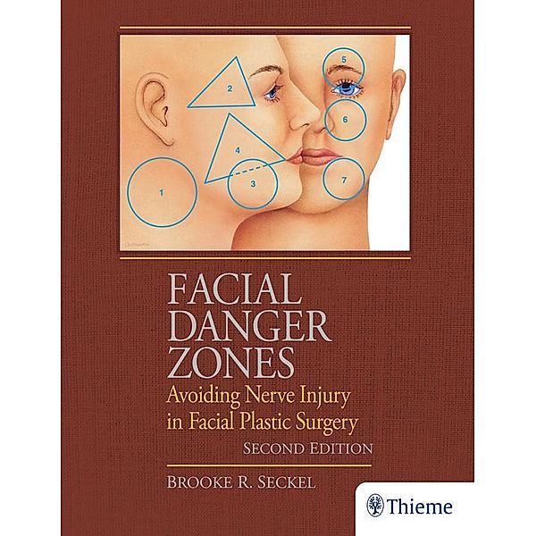 Facial Danger Zones, Brooke Seckel