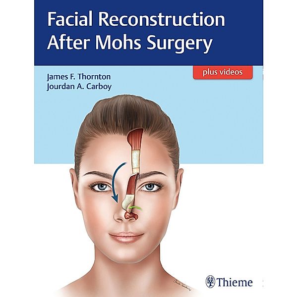 Facial Reconstruction After Mohs Surgery