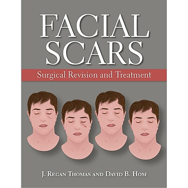 Facial Scars