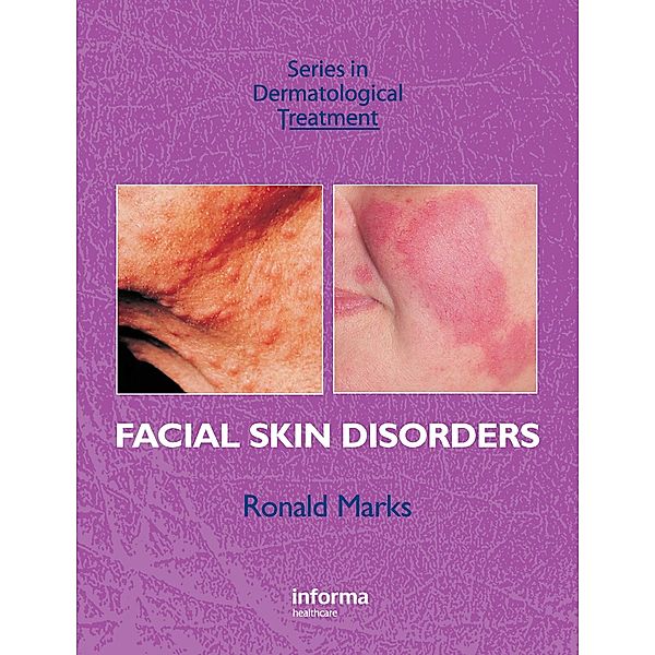 Facial Skin Disorders, Ronald Marks
