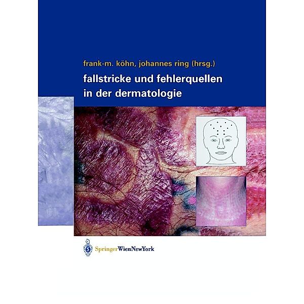 Fallstricke und Fehlerquellen in der Dermatologie