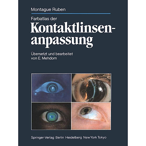 Farbatlas der Kontaktlinsenanpassung, Montague Ruben