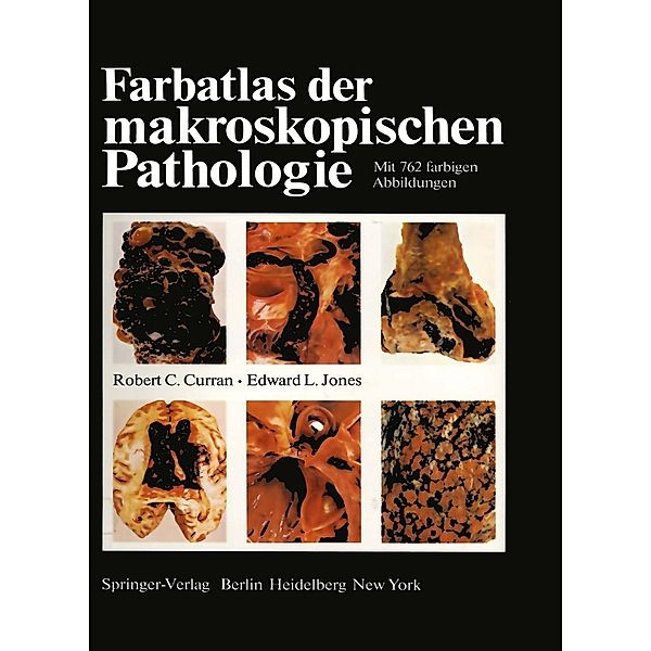 Farbatlas der makroskopischen Pathologie, R. C. Curran, E. L. Jones