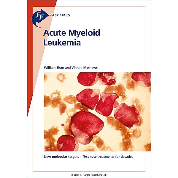Fast Facts: Acute Myeloid Leukemia, W. Blum, V. Mathews