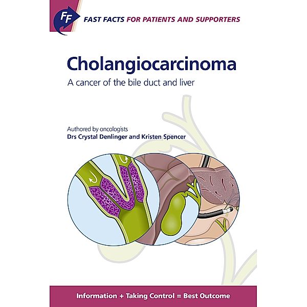 Fast Facts: Cholangiocarcinoma for Patients and their Supporters, C. Denlinger, K. Spencer