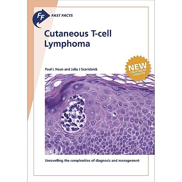 Fast Facts: Cutaneous T-cell Lymphoma, P. L. Haun, J. J. Scarisbrick