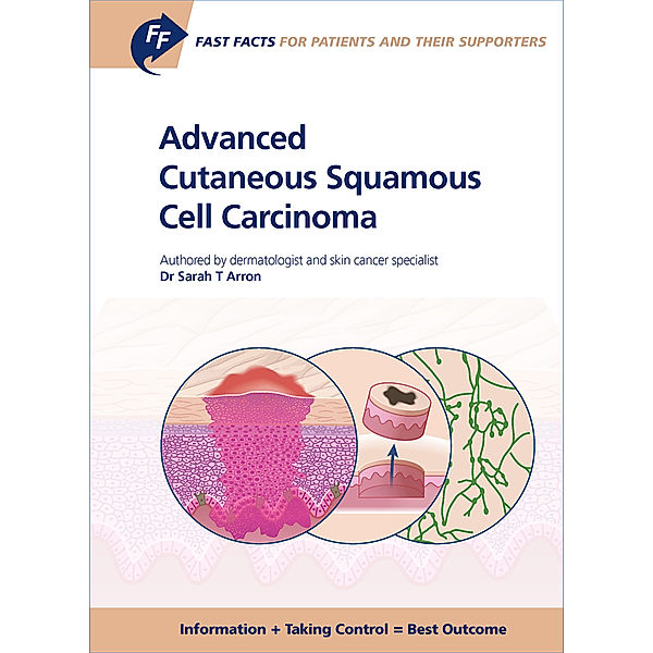 Fast Facts for Patients and their Supporters: Advanced Cutaneous Squamous Cell Carcinoma, Sarah T. Arron