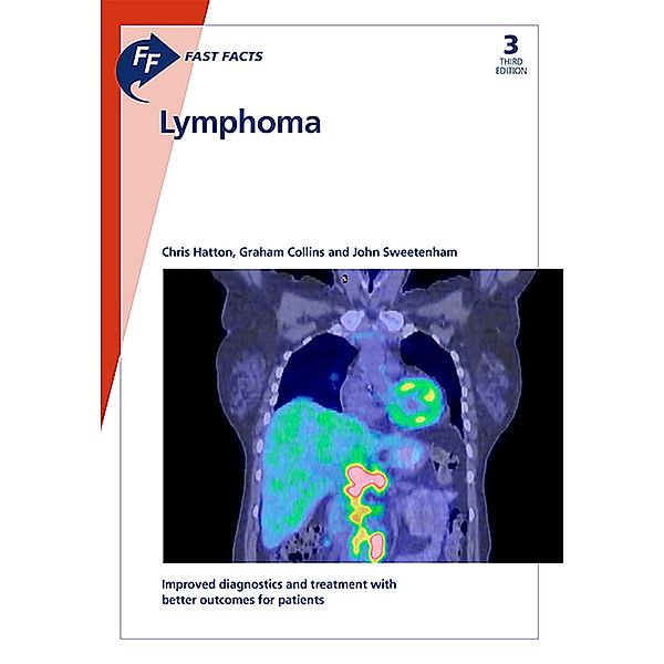 Fast Facts: Lymphoma, C. Hatton, G. Collins, J. Sweetenham