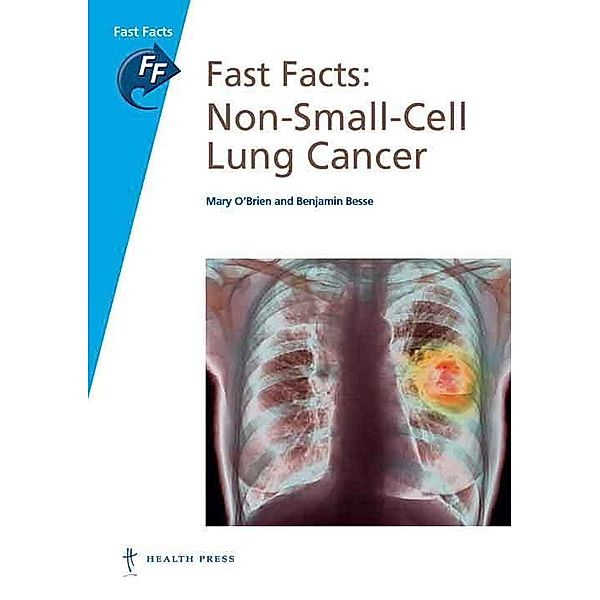 Fast Facts: Non-Small-Cell Lung Cancer, Benjamin Besse, Mary OBrien