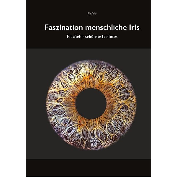 Fasziniation menschliche Iris, R. K. Flatfield