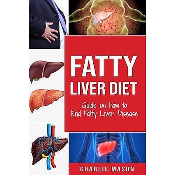 Fatty Liver Diet Guide on How to End Fatty Liver Disease Fatty Liver Diet Books / Tilcan Group Limited, Charlie Mason