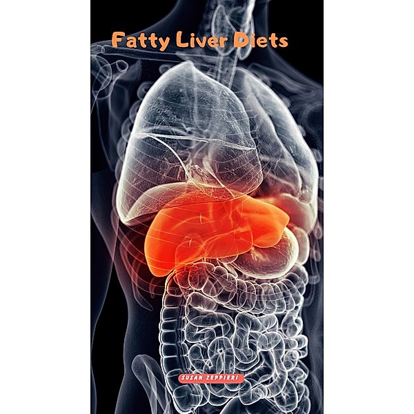 Fatty Liver Diets, Susan Zeppieri