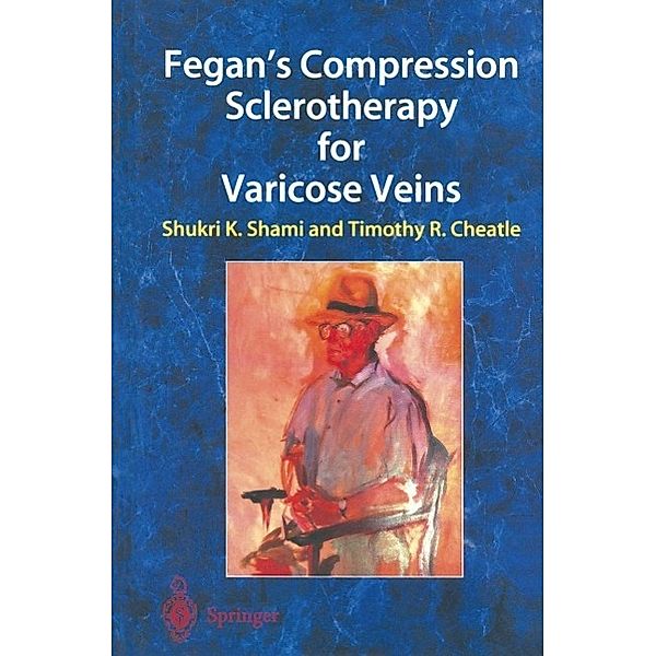 Fegan's Compression Sclerotherapy for Varicose Veins