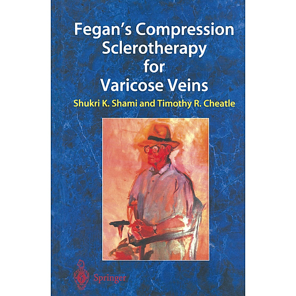 Fegan's Compression Sclerotherapy for Varicose Veins