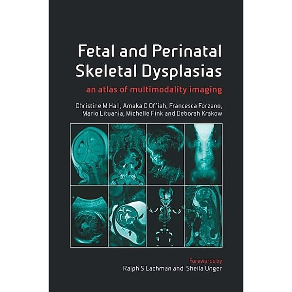 Fetal and Perinatal Skeletal Dysplasias, Christine M Hall, Amaka C Offiah, Francesca Forzano, Mario Lituania, Michelle Fink, Deborah Krakow