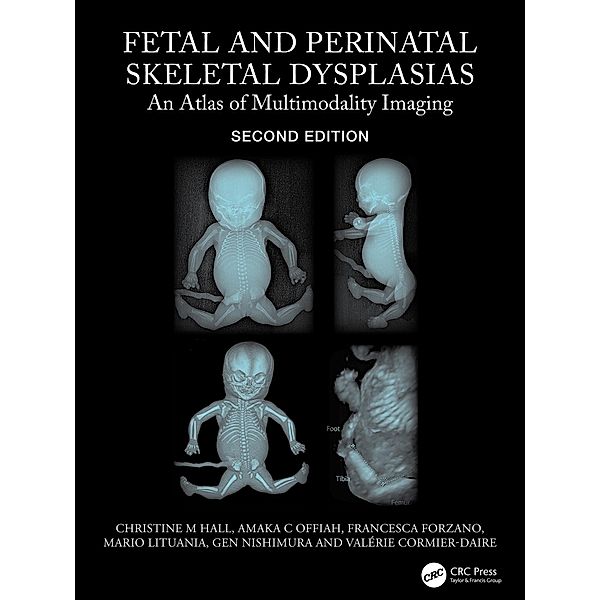 Fetal and Perinatal Skeletal Dysplasias, Christine M Hall, Amaka C Offiah, Francesca Forzano, Mario Lituania, Gen Nishimura, Valerie Cormier-Daire