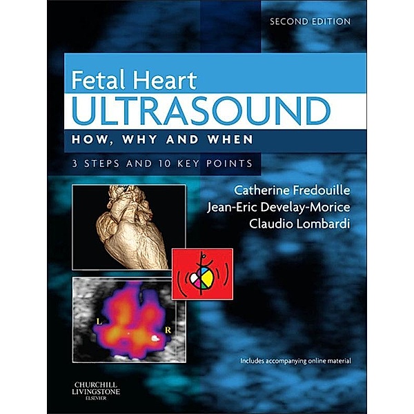 Fetal Heart Ultrasound - E-Book, Catherine Fredouille, Jean-Eric Develay-Morice, Claudio Lombardi