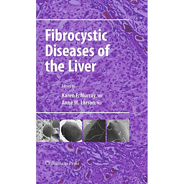 Fibrocystic Diseases of the Liver