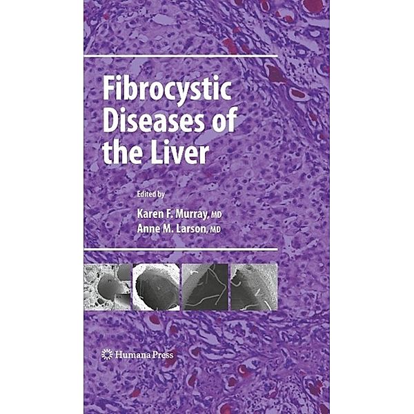 Fibrocystic Diseases of the Liver / Clinical Gastroenterology