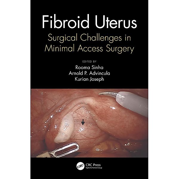 Fibroid Uterus