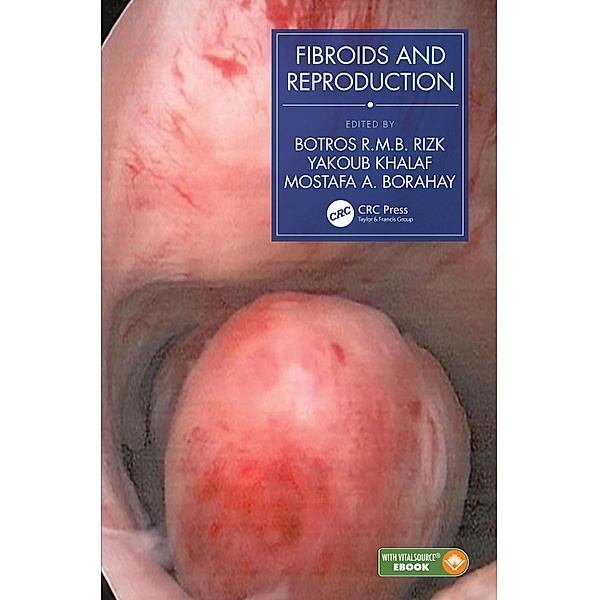 Fibroids and Reproduction