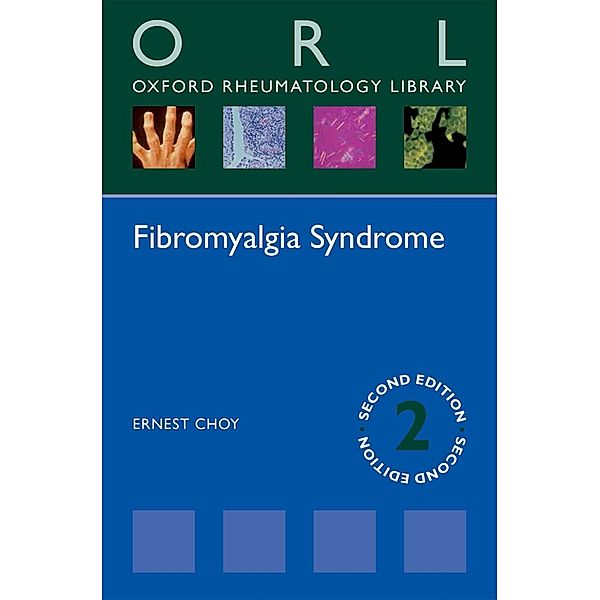 Fibromyalgia Syndrome / Oxford Rheumatology Library, Ernest Choy