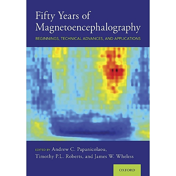 Fifty Years of Magnetoencephalography