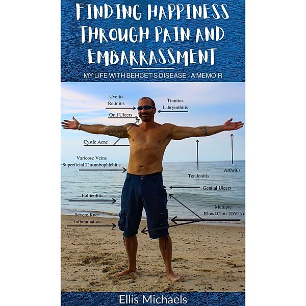 Finding Happiness Through Pain And Embarrassment: My Life With Behcet's Disease - A Memoir, Ellis Michaels