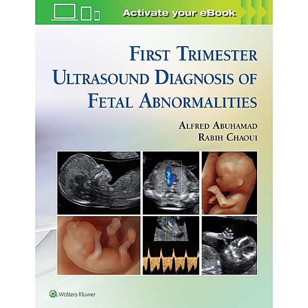 First Trimester Ultrasound Diagnosis of Fetal Abnormalities, Alfred Abuhamad, Rabih Chaoui