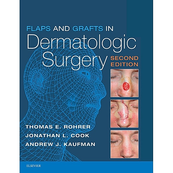 Flaps and Grafts in Dermatologic Surgery E-Book, Thomas E. Rohrer, Jonathan L. Cook, Andrew Kaufman
