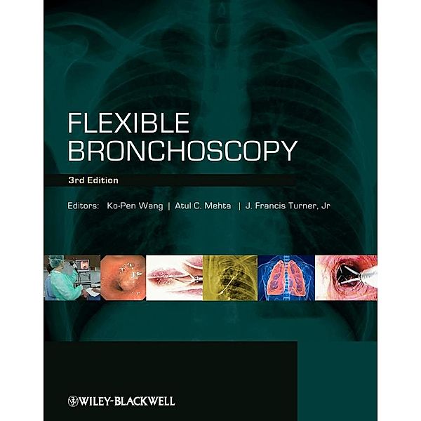 Flexible Bronchoscopy