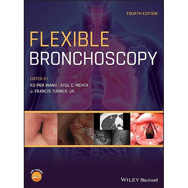 Flexible Bronchoscopy, Ko-Pen Wang, Atul C. Mehta, J. Francis Turner