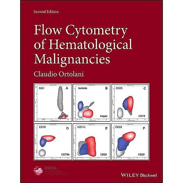 Flow Cytometry of Hematological Malignancies, Claudio Ortolani