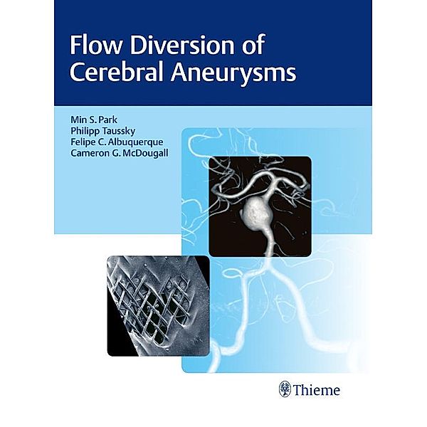 Flow Diversion of Cerebral Aneurysms, Min S. Park, Phil Taussky, Felipe C. Albuquerque, Cameron G. McDougall
