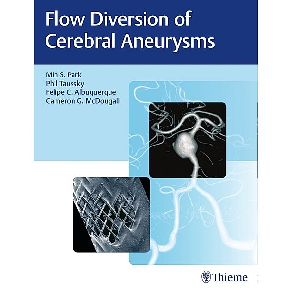 Flow Diversion of Cerebral Aneurysms, Min S. Park, Philipp Taussky, Felipe C. Albuquerque, Cameron G. McDougall