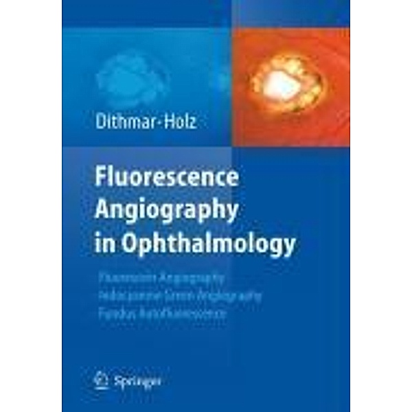 Fluorescence Angiography in Ophthalmology, Stefan Dithmar, Frank G. Holz