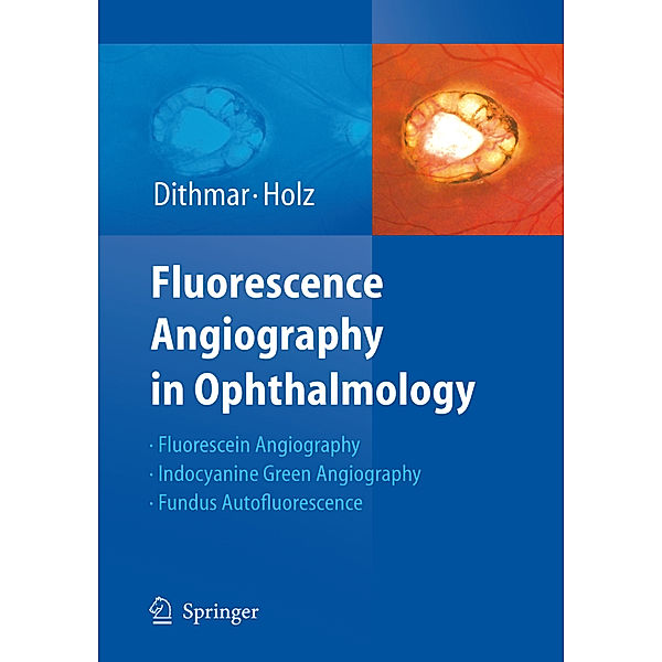 Fluorescence Angiography in Ophthalmology, Stefan Dithmar, Frank G Holz