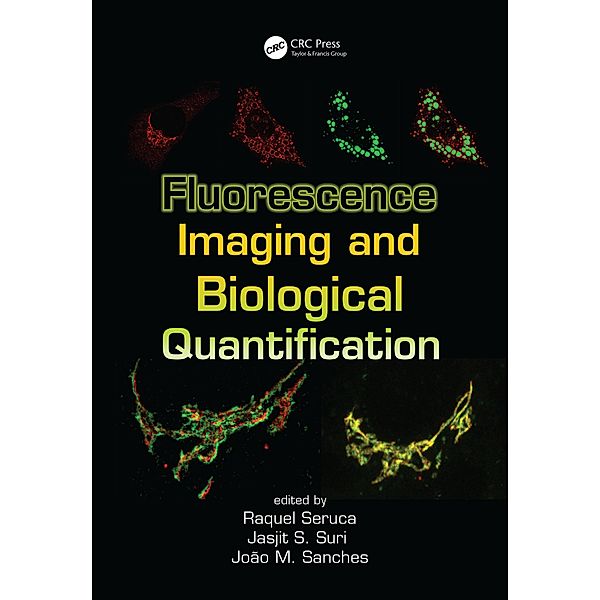 Fluorescence Imaging and Biological Quantification