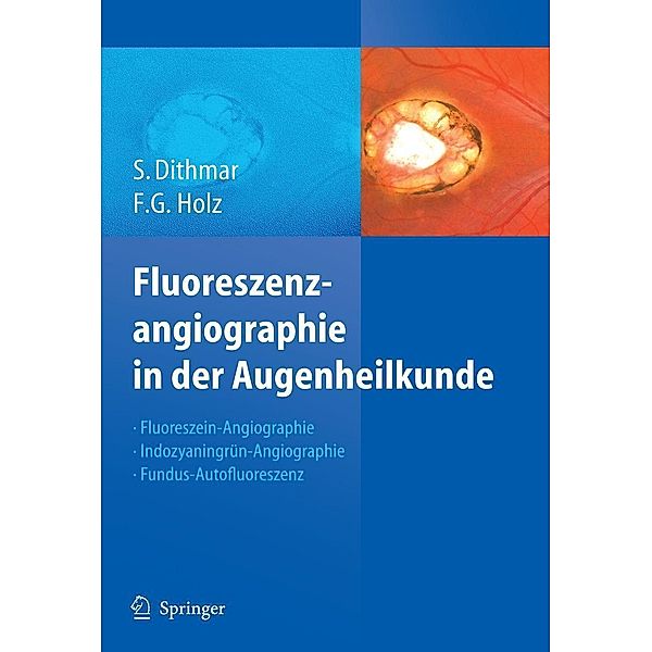 Fluoreszenzangiographie in der Augenheilkunde, Stefan Dithmar, Frank G. Holz