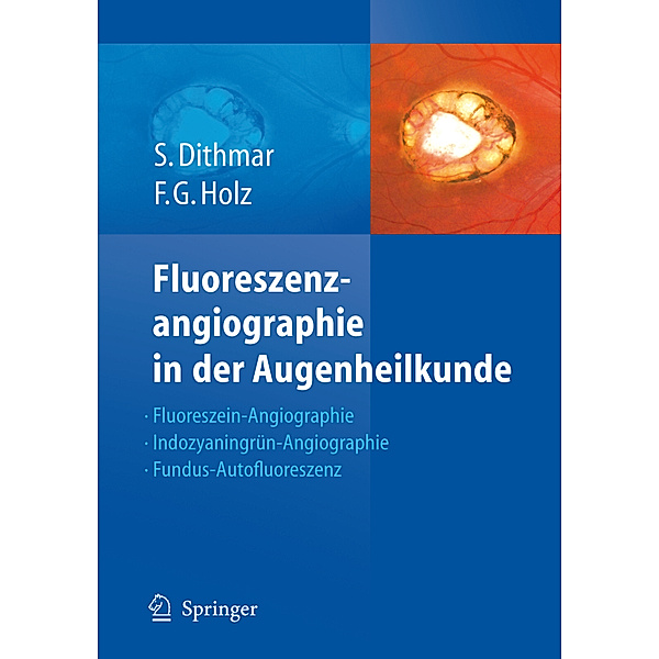 Fluoreszenzangiographie in der Augenheilkunde, Stefan Dithmar, Frank G Holz