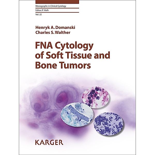 FNA Cytology of Soft Tissue and Bone Tumors, H. A. Domanski, C. S. Walther