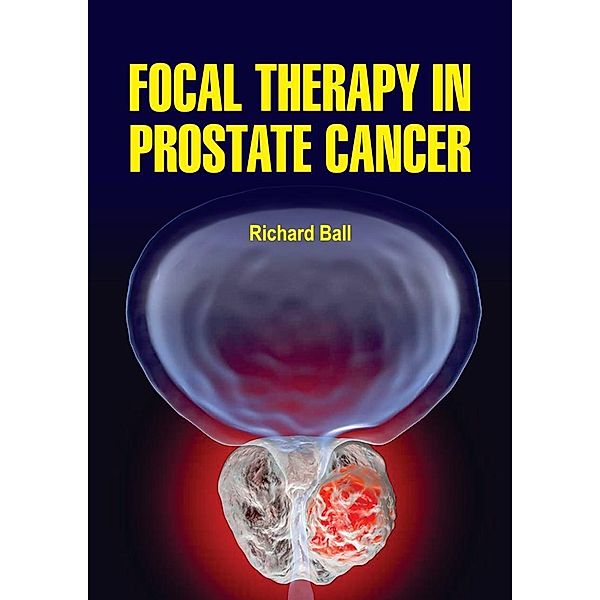 Focal Therapy in Prostate Cancer, Richard Ball