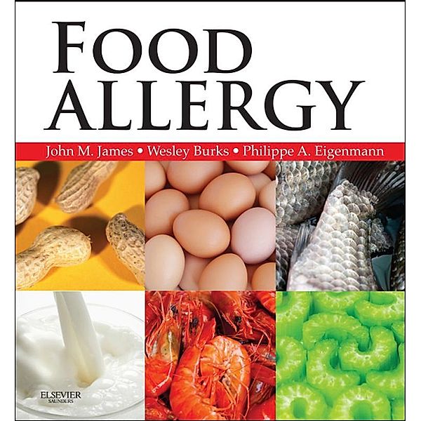Food Allergy E-Book, John M James, A Wesley Burks, Philippe Eigenmann