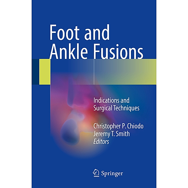 Foot and Ankle Fusions