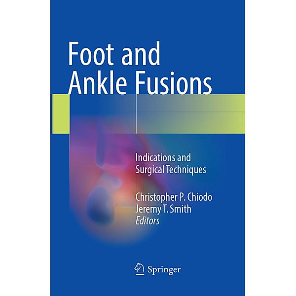Foot and Ankle Fusions